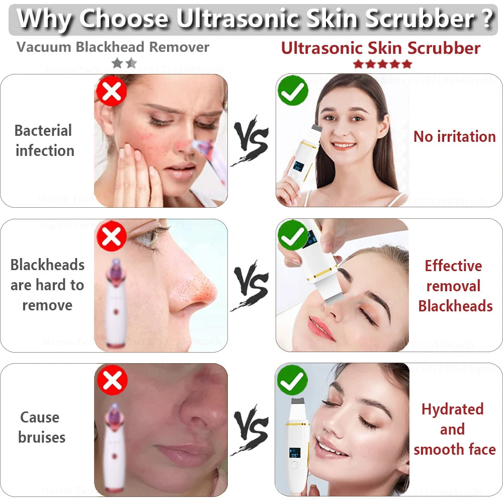 Ultrasonic Facial Scrubber Pro